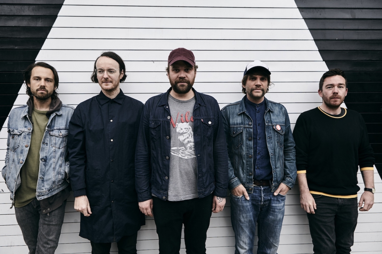 Frightened Rabbit are auctioning off gear to raise money for their Tiny Changes charity